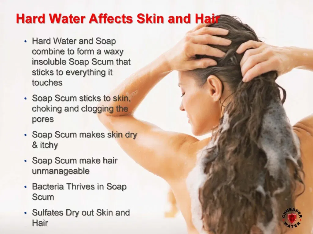 listof Affects of hard water on skin & hair